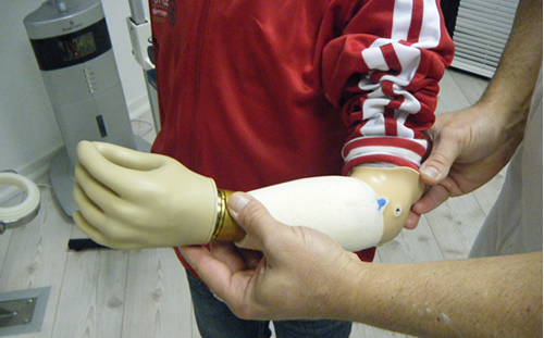 Forearm Structure