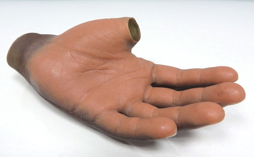 Silicone Hand Prosthesis