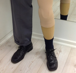 Completed Prosthetic Leg