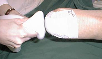 Silicone Liner