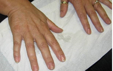 Silicone Finger