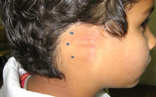 Skin Markings